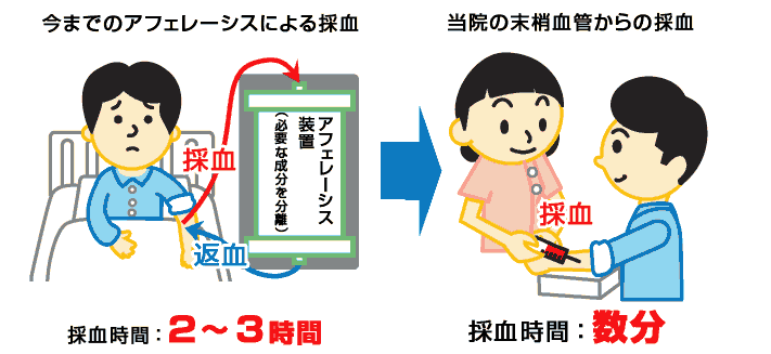 アフェレーシス(成分採血)不要