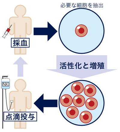 活性ＮＫ細胞療法の流れ