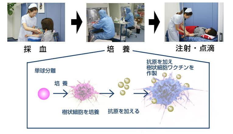 新樹状細胞ワクチン治療の概要