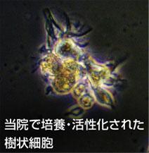 樹状細胞