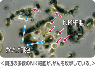 NK細胞