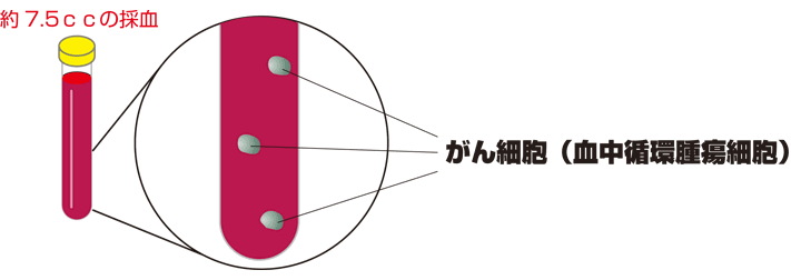 早期がん予知検査は血液(約7.5㏄)を採血する検査